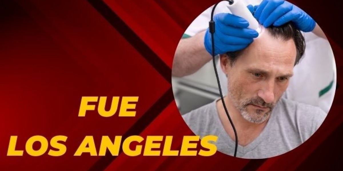 How Does FUE Hair Transplant Work in Los Angeles?