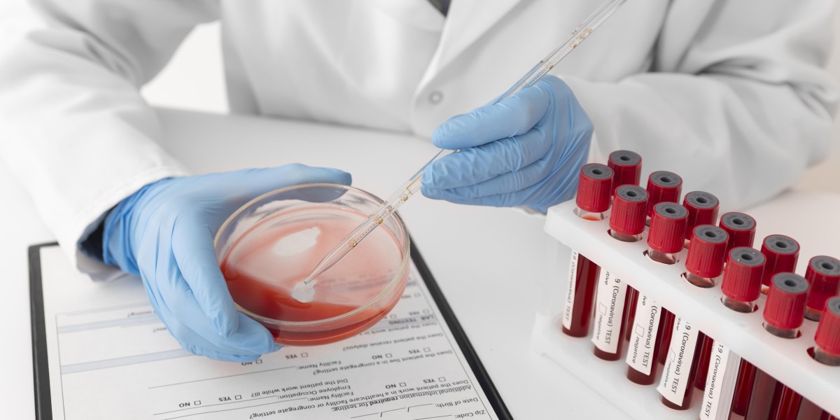 Blood Transfusion Diagnostics Market Share, Size, Trends, Industry Analysis Report, By Type  By Region; Segment Forecast