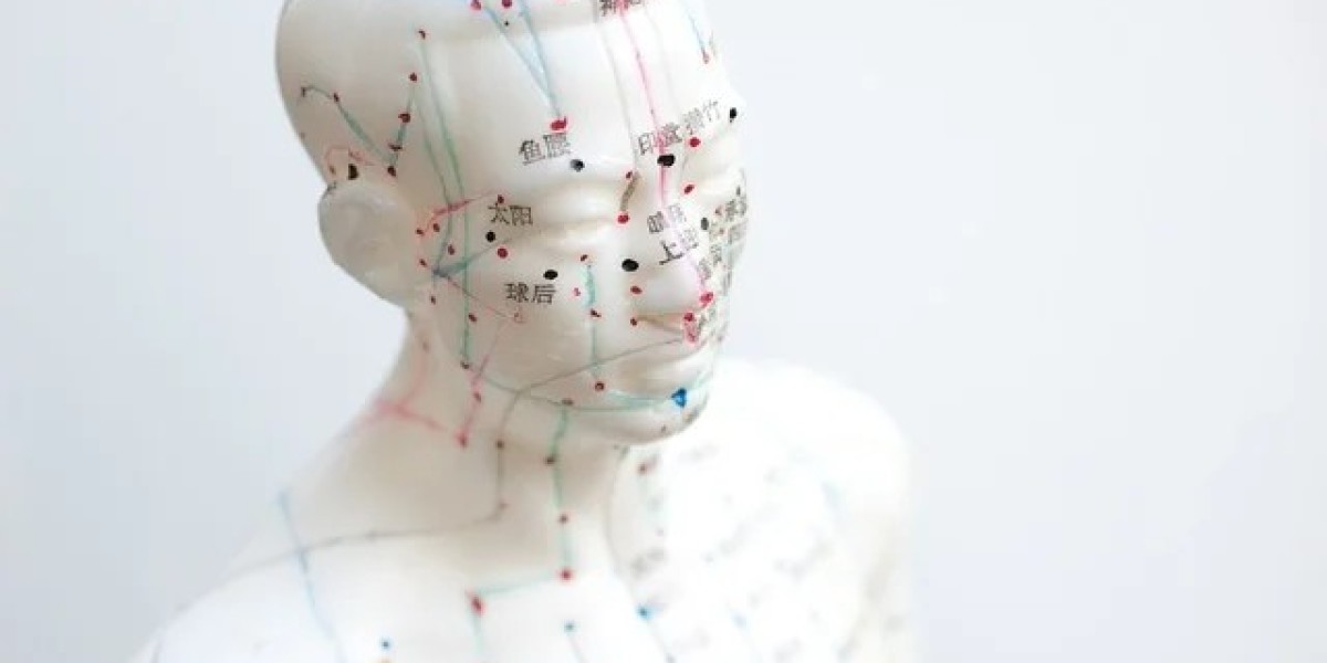How to benefit more from Acupuncture (TCM)