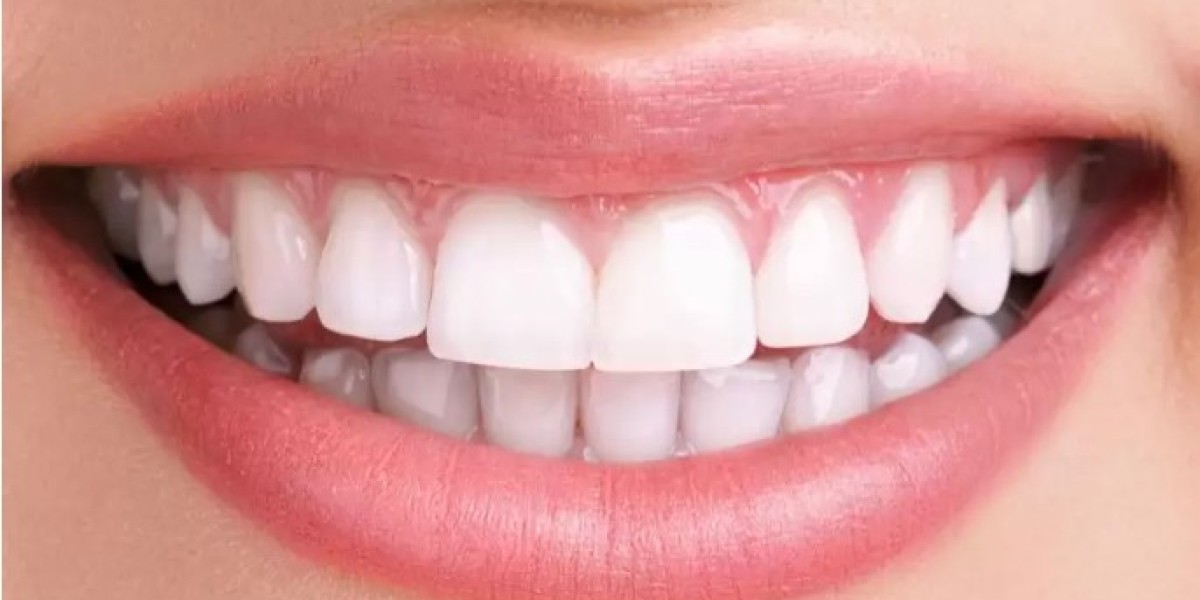 teeth whitening in abu dhabi