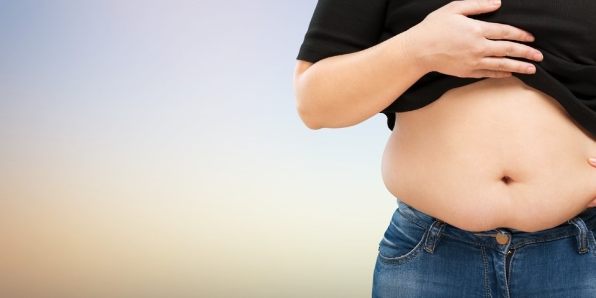 Revision Bariatric Surgery in Dubai: A Step-by-Step Journey