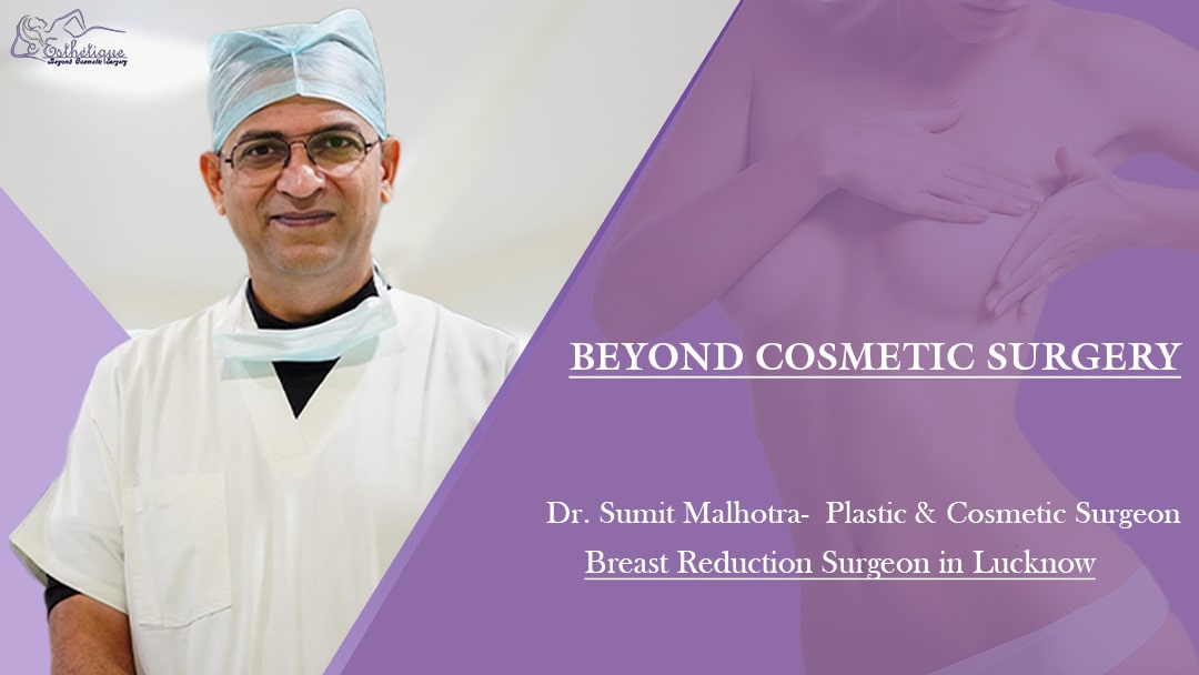 Mammaplasty Or Breast Reduction Surgery in Lucknow | Dr. Sumit Malhotra