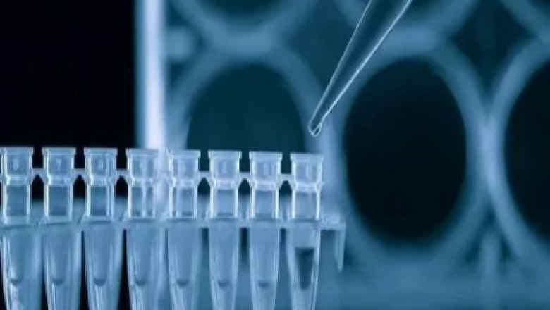 What is Glycated Albumin and its Role in Diabetes Management | Times Square Reporter
