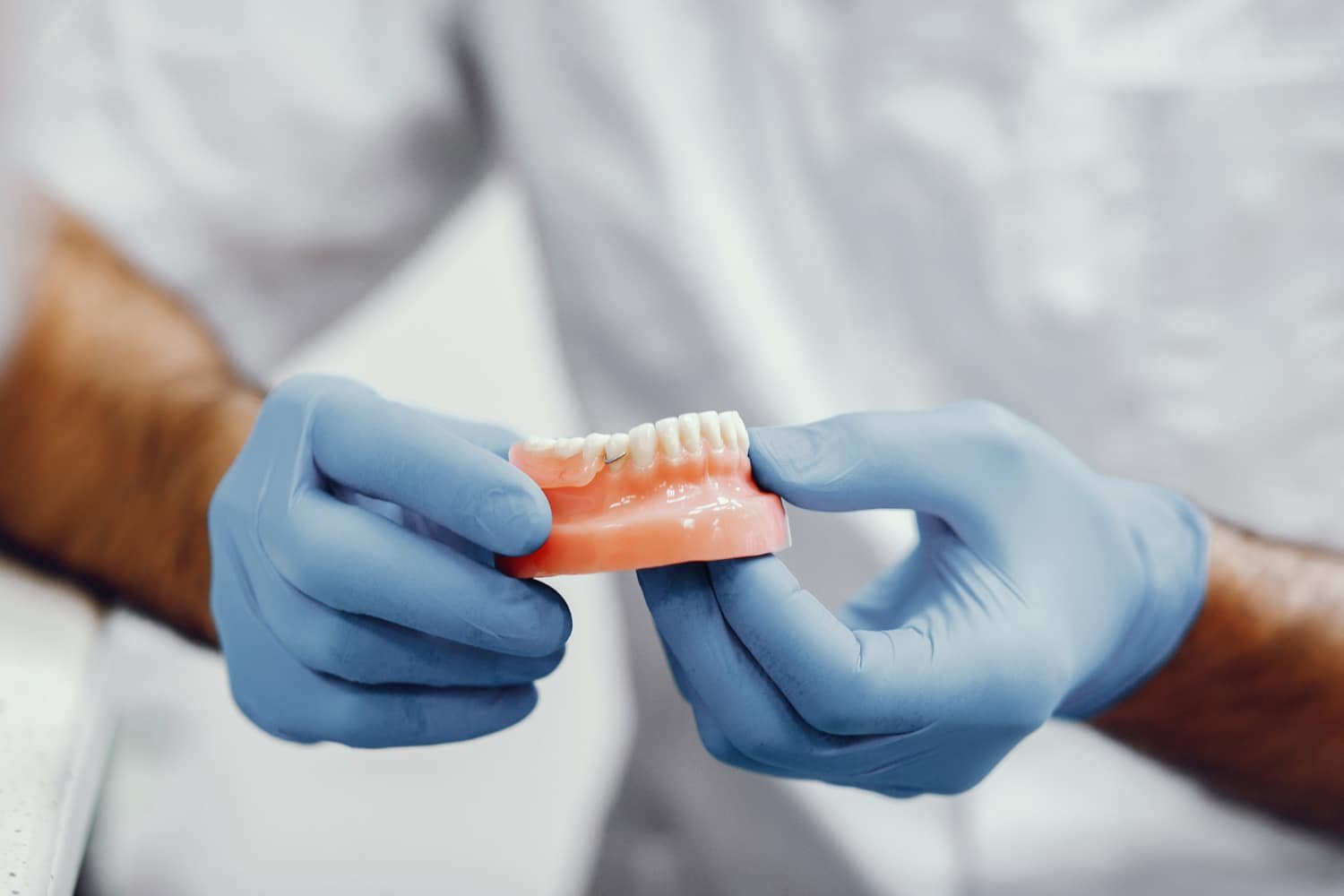 Dentures: Types, Benefits & Cost in Turkey- Suave Dental Clinic