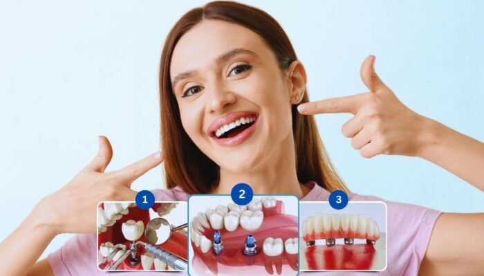 Cosmetic Dentistry in Nelson BC | Heritage Family Dental