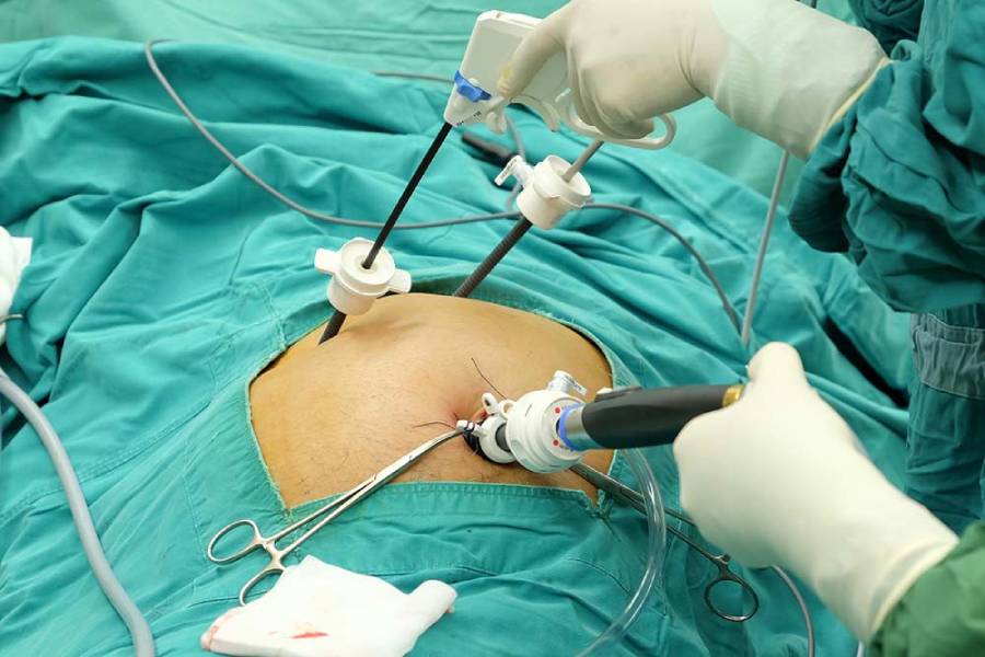 Gallbladder Removal Surgery in Pune- Kaizen Gastro Care