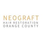 Neograft Hair Restoration Orange County Profile Picture