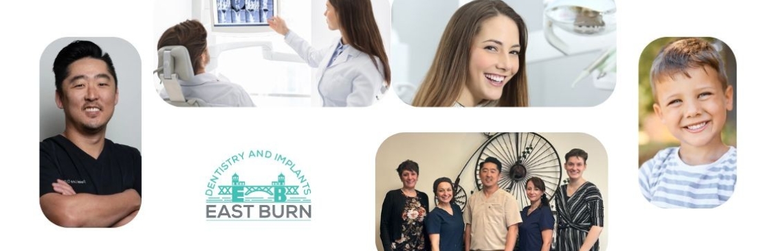 East Burn Dentistry  Implants Cover Image