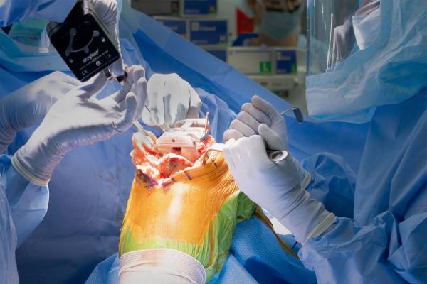 Knee Replacement Surgery in PCMC – Dr. Ashutosh Jadhav